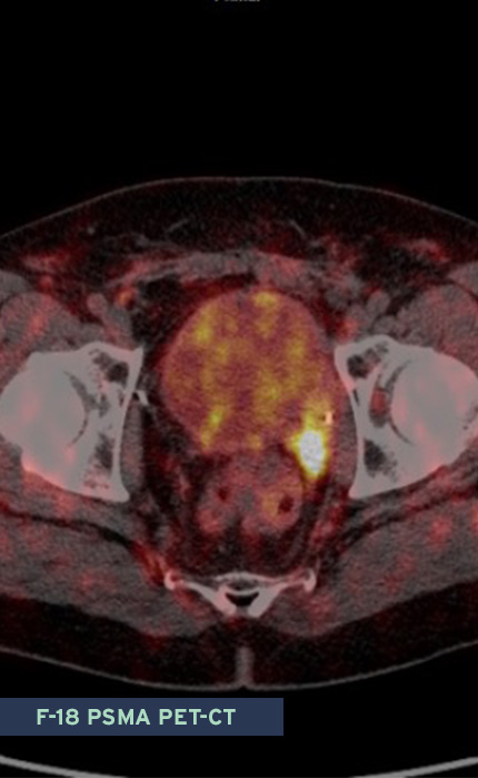 Ultraschalluntersuchungen, Radiologisches Gutachten | Radiologischer Befundbericht | Praxis für Radiologie & Nuklearmedizin