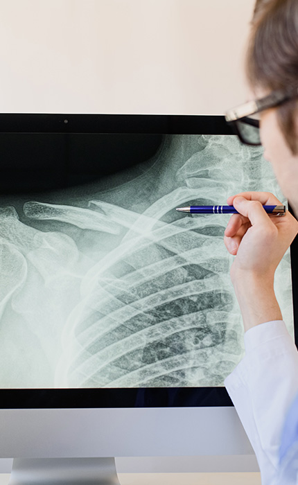 Bildgebende Verfahren, CT (Computertomographie) | Strahlenexposition | Praxis für Radiologie & Nuklearmedizin