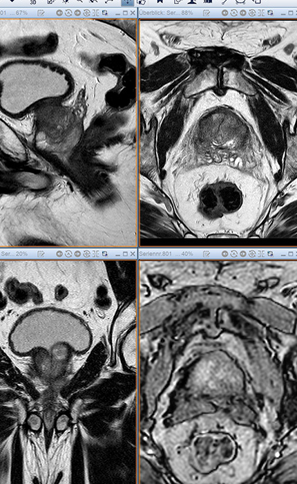 CT (Computertomographie), Strahlentherapie | Interventionelle Radiologie | Praxis für Radiologie & Nuklearmedizin