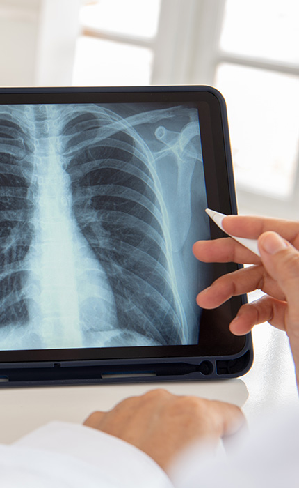 Strahlentherapie, Ultraschalluntersuchungen | Radiologischer Befund | Praxis für Radiologie & Nuklearmedizin