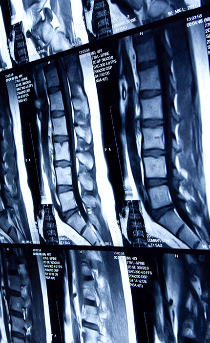 Radiologische Diagnostik, Strahlentherapie | Interventionelle Radiologie | Praxis für Radiologie & Nuklearmedizin