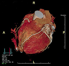 MRT (Magnetresonanztomographie), Bildgebende Verfahren | Röntgenaufnahmen | Praxis für Radiologie & Nuklearmedizin