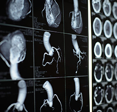 Nuklearmedizin, MRT (Magnetresonanztomographie) | Radiologischer Befundbericht | Praxis für Radiologie & Nuklearmedizin
