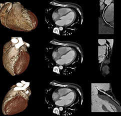 CT (Computertomographie), Ultraschalluntersuchungen | Strahlenexposition | Praxis für Radiologie & Nuklearmedizin