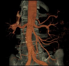 Nuklearmedizin, Bildgebende Verfahren | Strahlenexposition | Praxis für Radiologie & Nuklearmedizin