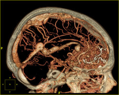 Radiologische Diagnostik, CT (Computertomographie) | Radiologischer Befundbericht | Praxis für Radiologie & Nuklearmedizin