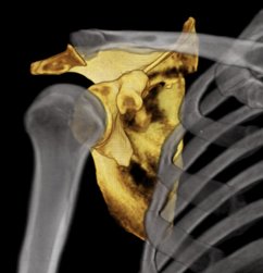 Ultraschalluntersuchungen, Radiologisches Gutachten | Radiologischer Befundbericht | Praxis für Radiologie & Nuklearmedizin