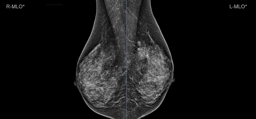 CT (Computertomographie), MRT (Magnetresonanztomographie) | Radiologischer Befund | Praxis für Radiologie & Nuklearmedizin