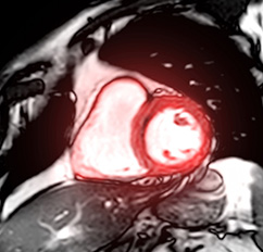 Radiologisches Gutachten, Radiologische Diagnostik | Radiologischer Befundbericht | Praxis für Radiologie & Nuklearmedizin