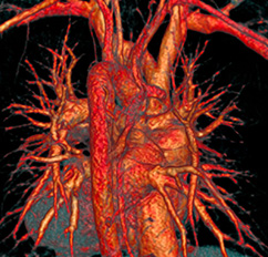 MRT (Magnetresonanztomographie), Strahlentherapie | Strahlenexposition | Praxis für Radiologie & Nuklearmedizin