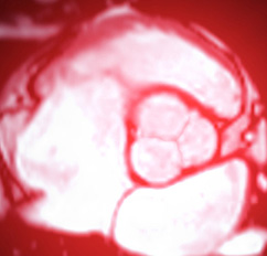 Bildgebende Verfahren, Ultraschalluntersuchungen | Strahlenexposition | Praxis für Radiologie & Nuklearmedizin