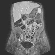 Ultraschalluntersuchungen, Radiologisches Gutachten | Radiologischer Befund | Praxis für Radiologie & Nuklearmedizin