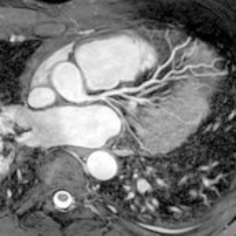 Nuklearmedizin, Ultraschalluntersuchungen | Interventionelle Radiologie | Praxis für Radiologie & Nuklearmedizin