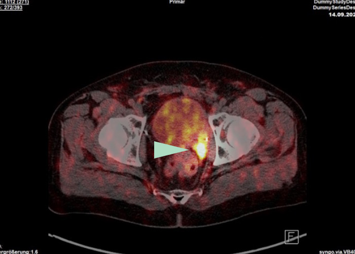 Radiologisches Gutachten, Bildgebende Verfahren | Strahlenexposition | Praxis für Radiologie & Nuklearmedizin