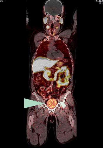 MRT (Magnetresonanztomographie), Nuklearmedizin | Röntgenaufnahmen | Praxis für Radiologie & Nuklearmedizin