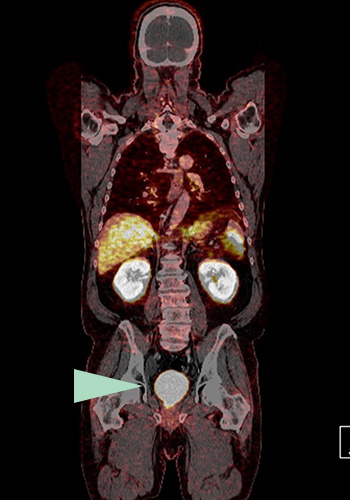 Radiologisches Gutachten, Radiologische Diagnostik | Radiologischer Befundbericht | Praxis für Radiologie & Nuklearmedizin