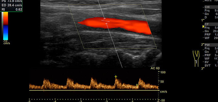 MRT (Magnetresonanztomographie), Ultraschalluntersuchungen | Interventionelle Radiologie | Praxis für Radiologie & Nuklearmedizin