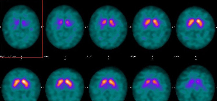 Radiologische Diagnostik, MRT (Magnetresonanztomographie) | Interventionelle Radiologie | Praxis für Radiologie & Nuklearmedizin