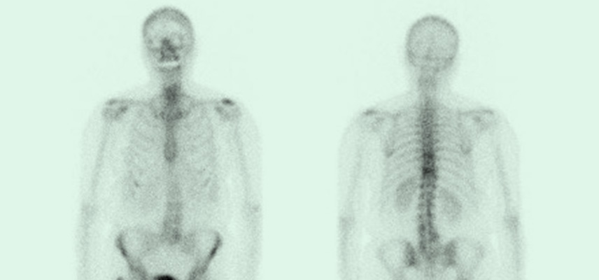 Strahlentherapie, MRT (Magnetresonanztomographie) | Interventionelle Radiologie | Praxis für Radiologie & Nuklearmedizin