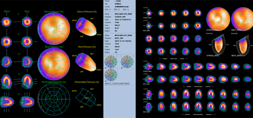 Nuklearmedizin, Radiologisches Gutachten | Strahlenexposition | Praxis für Radiologie & Nuklearmedizin