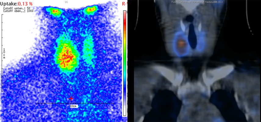 Radiologische Diagnostik, MRT (Magnetresonanztomographie) | Radiologischer Befund | Praxis für Radiologie & Nuklearmedizin