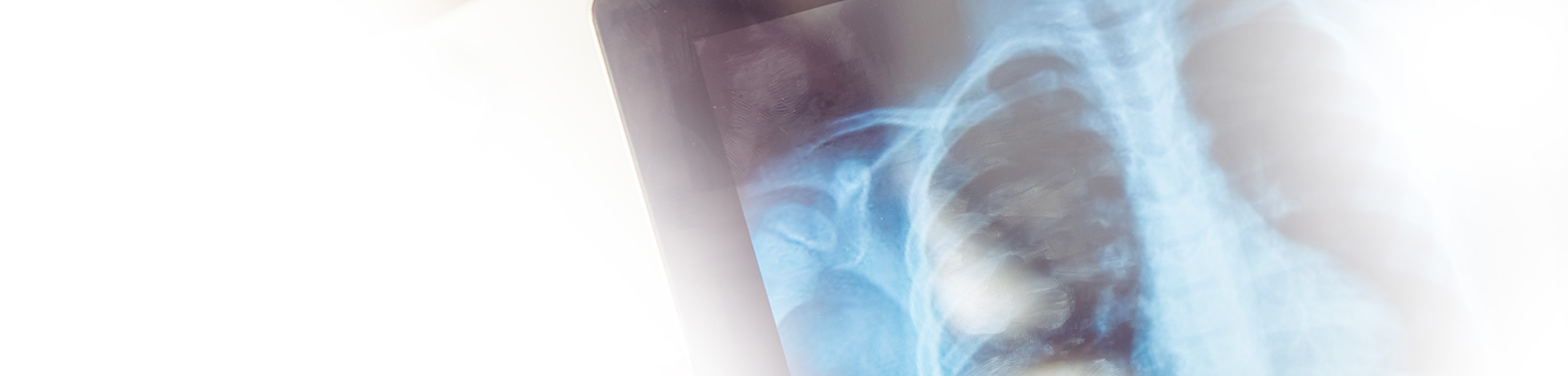 MRT (Magnetresonanztomographie), CT (Computertomographie) | Strahlenexposition | Praxis für Radiologie & Nuklearmedizin