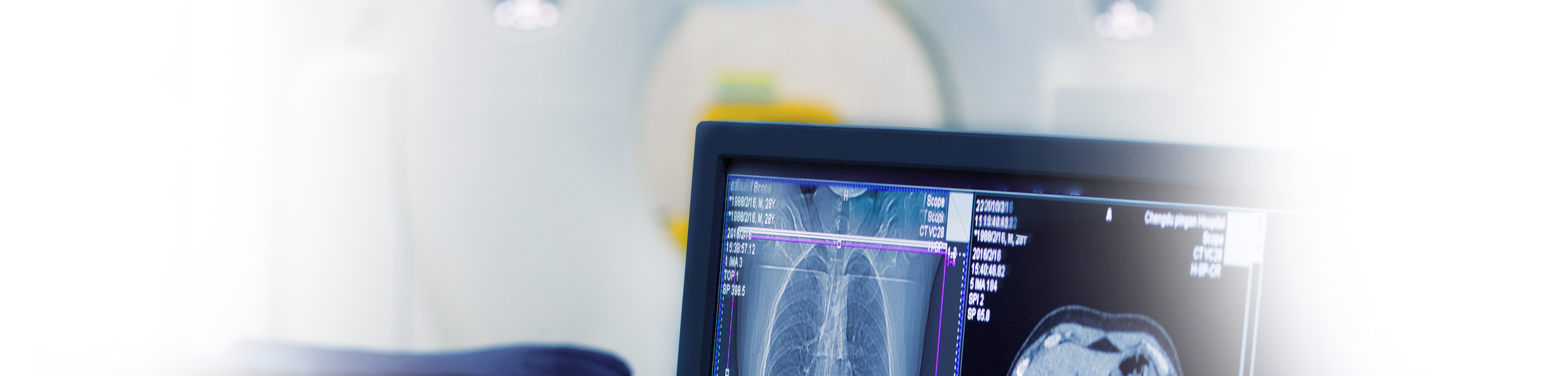 Ultraschalluntersuchungen, Radiologisches Gutachten | Röntgenaufnahmen | Praxis für Radiologie & Nuklearmedizin